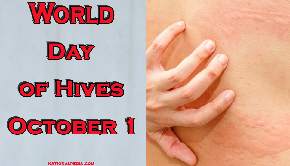 World Day of Hives October 1