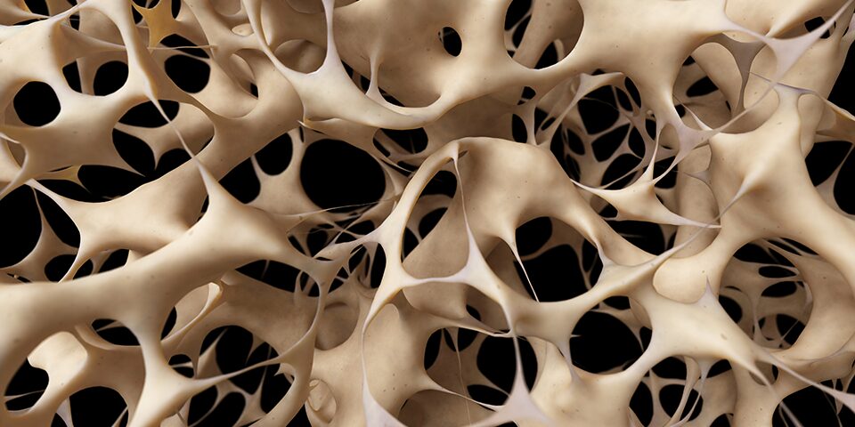 World Day of Osteoporosis October 20