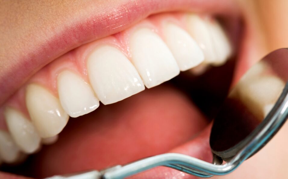 World Oral Health Day March 20