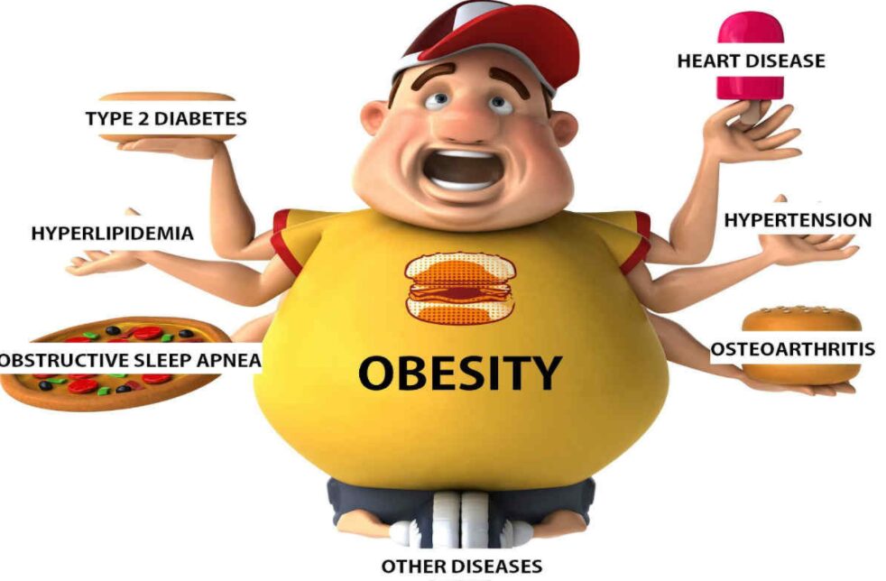 European Day of Obesity May 19