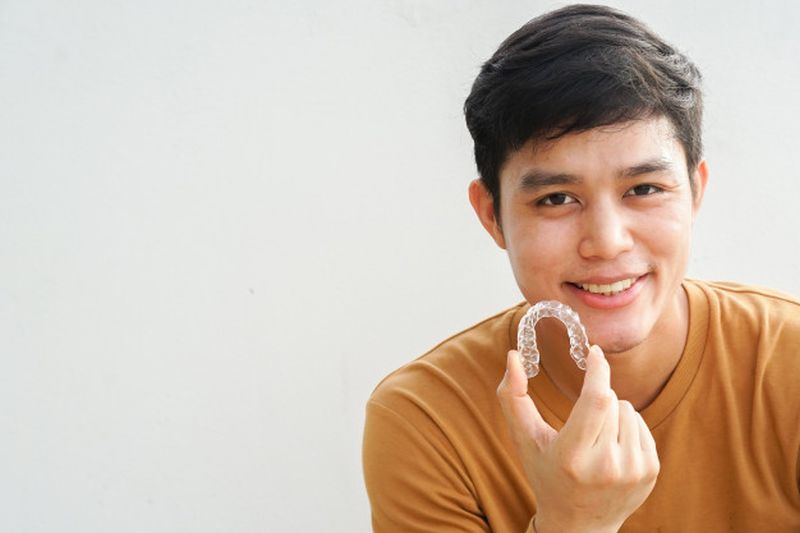 Clear Aligners3