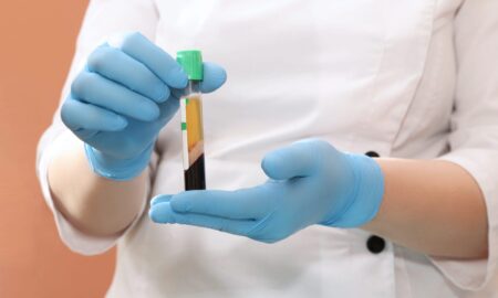 Platelet Rich Plasma Therapy